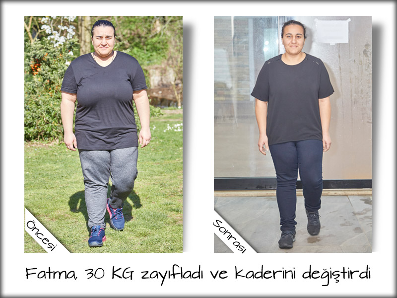 Fatma - 30 kg