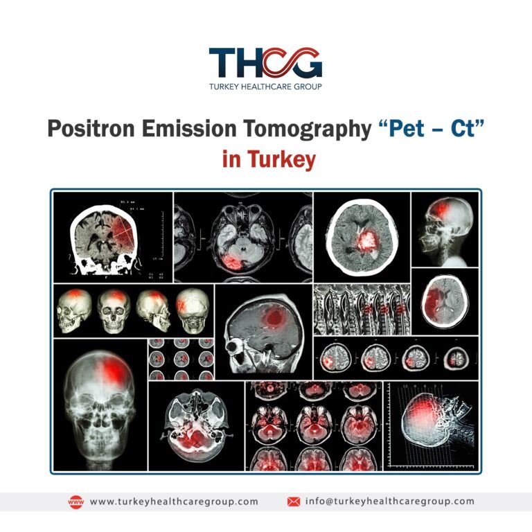 Positron Emission Tomography “Pet – Ct “in Turkey