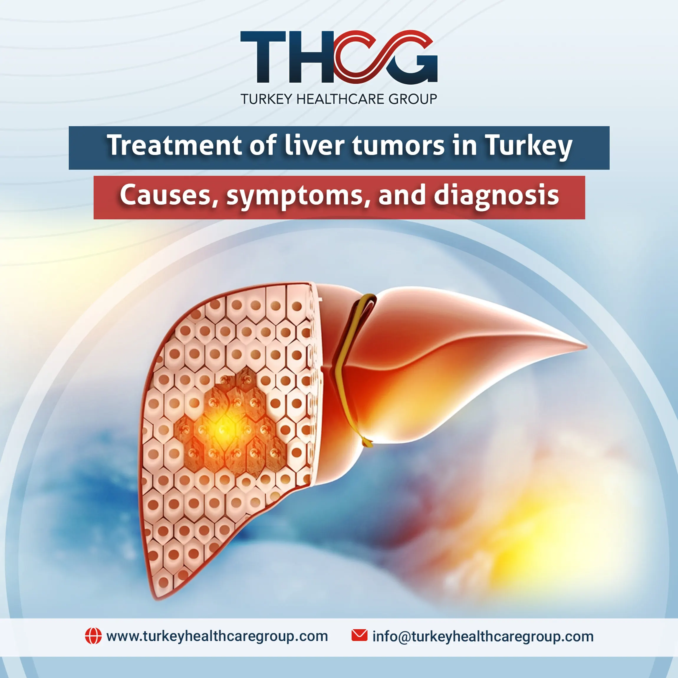 Treatment of liver tumors