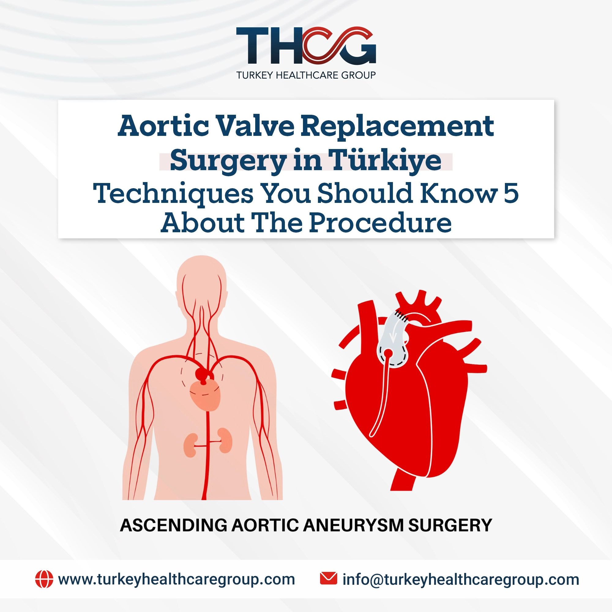 Aortic Valve Replacement Surgery in Türkiye: 5 Techniques You Should Know