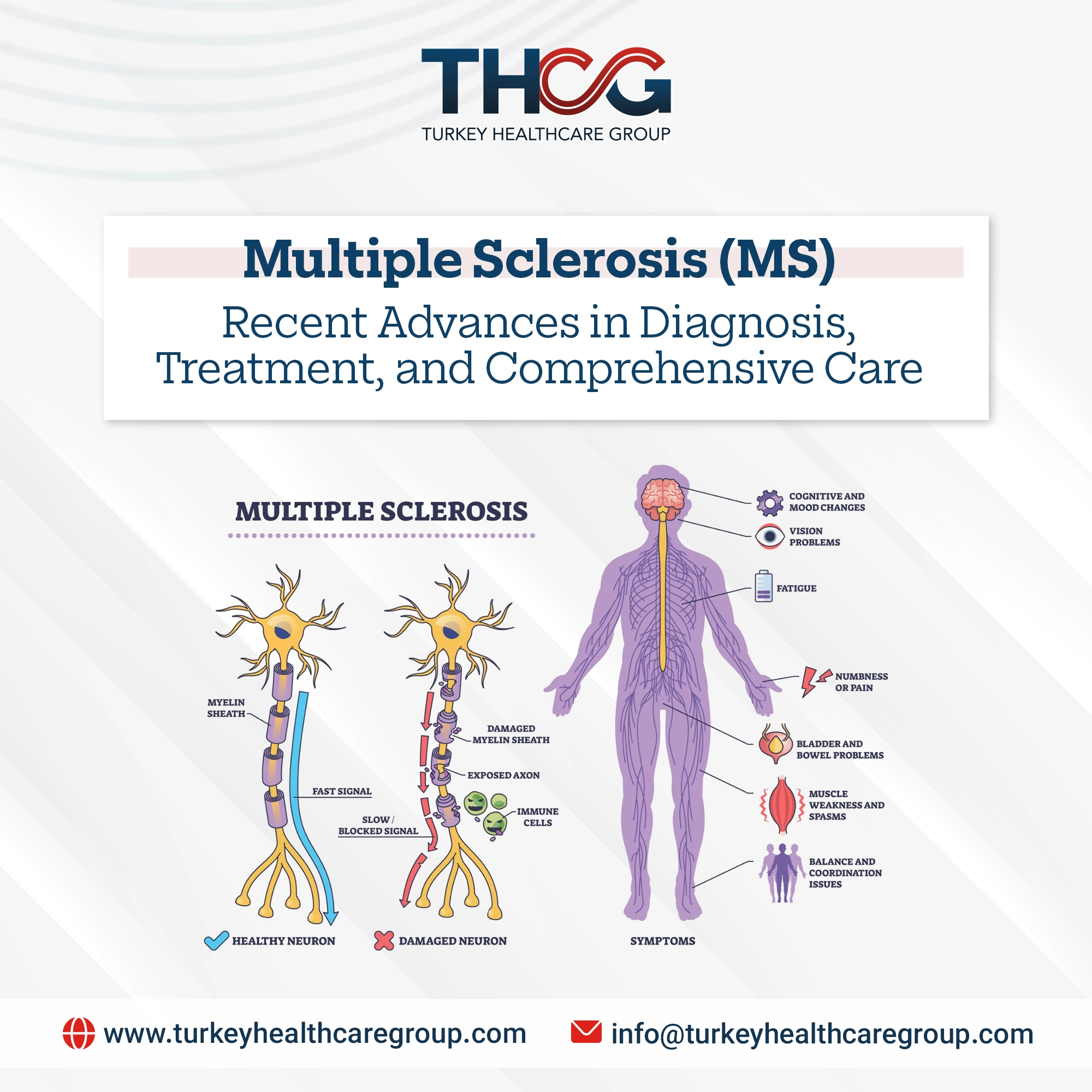 Multiple Sclerosis (MS): Advances in Diagnosis & Treatment | 2026